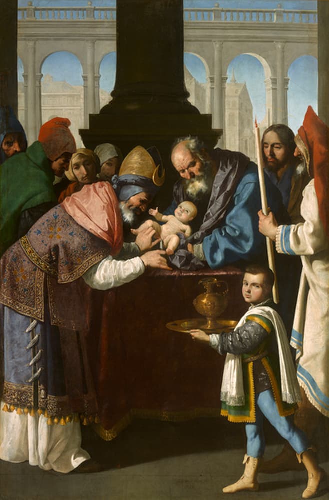 Circumcision