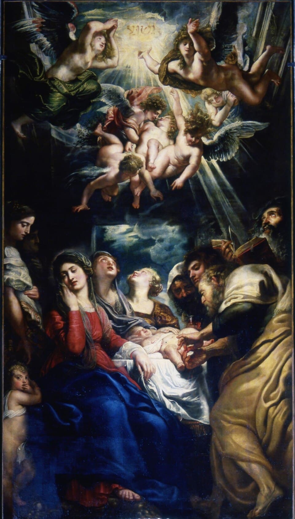 The Circumcision of Christ